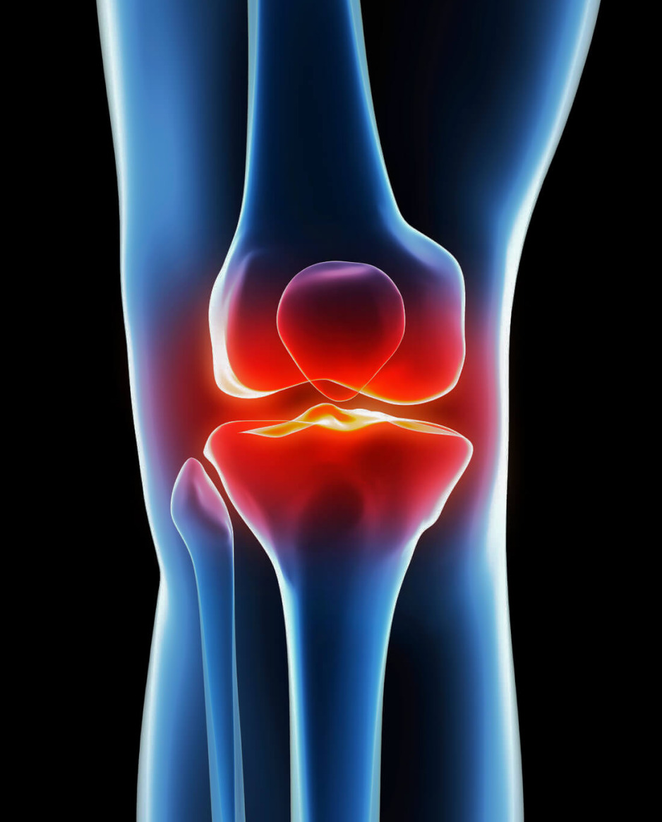 Knee Conditions