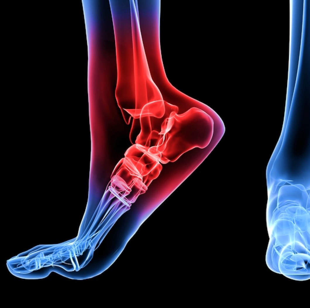Foot & Ankle Conditions