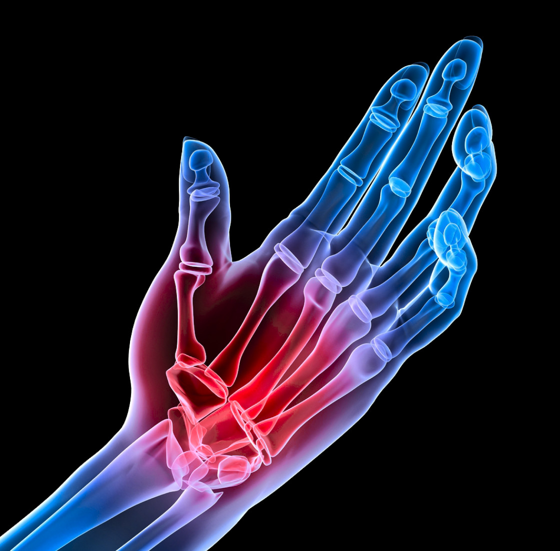 Hand & Wrist Conditions