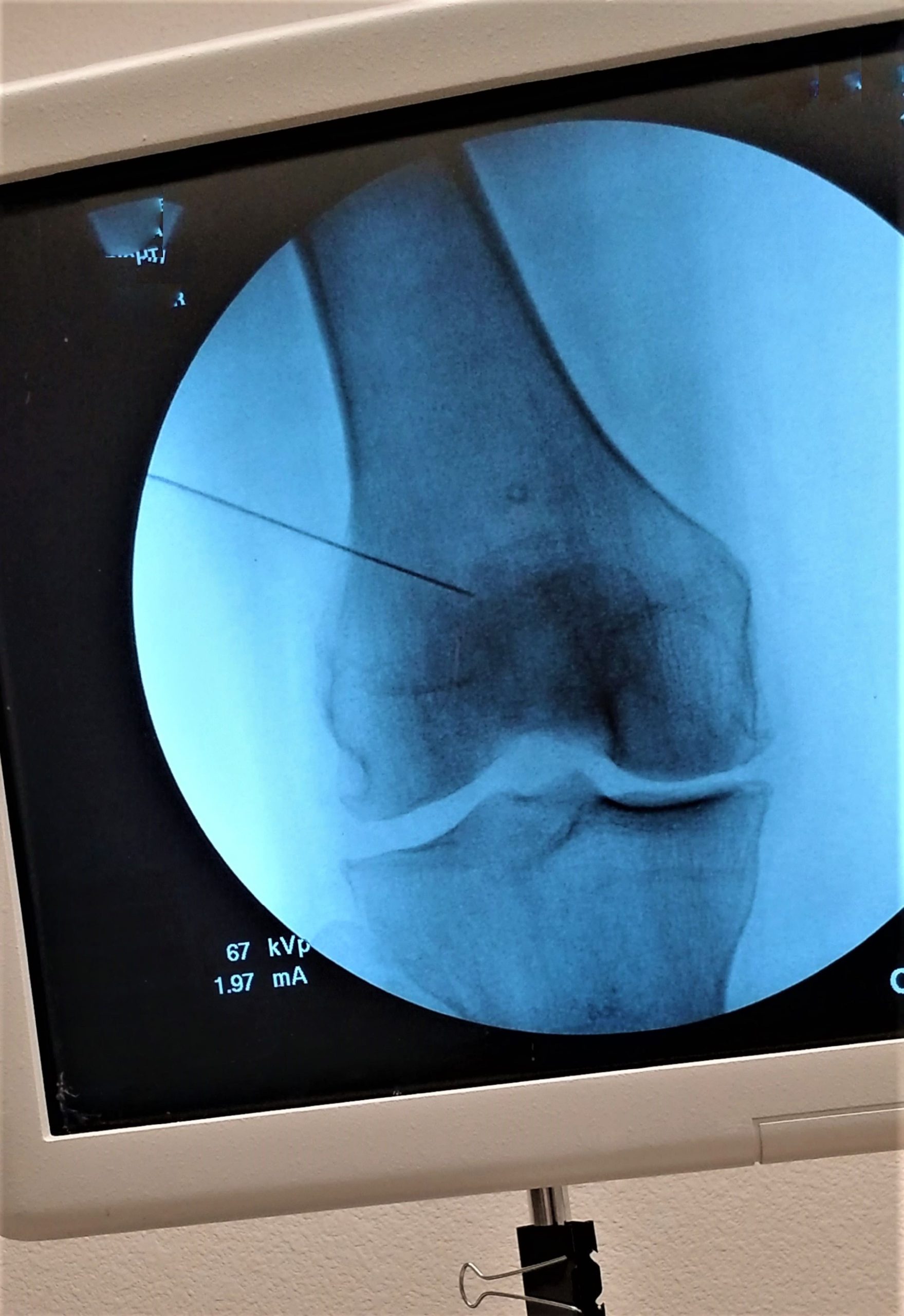 at-the-doctor-healthcare-and-medicine-pain-manag-2026-03-09-01-52-09-utc (1)