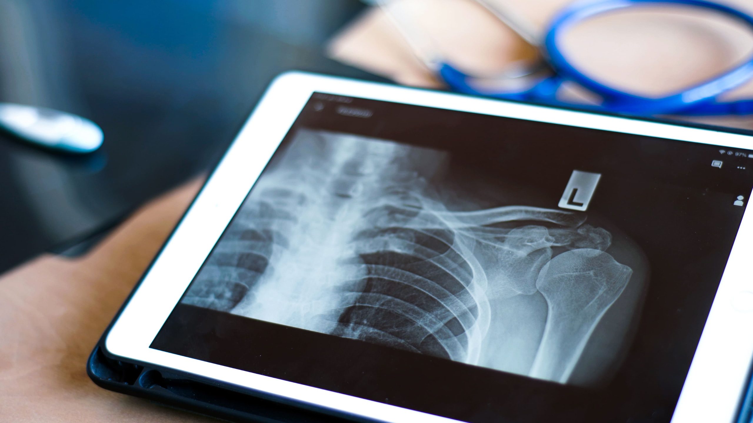 A close-up of an X-ray image displayed on a tablet, showing the upper body and shoulder area.