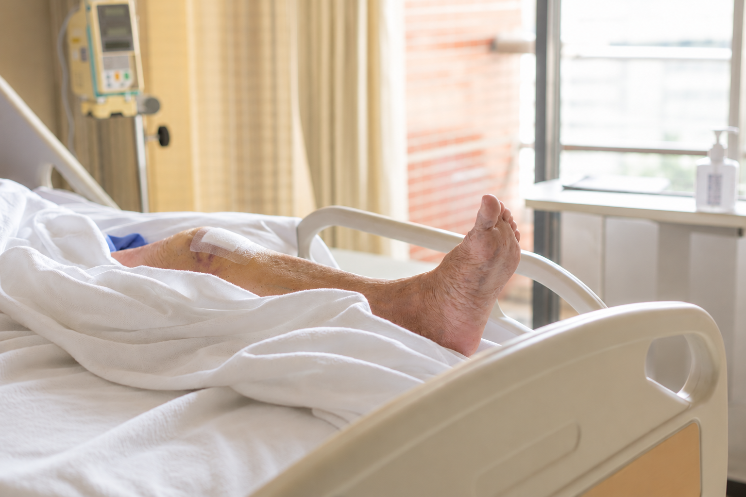 Elderly Patient’s Bandaged Knee in Hospital Bed